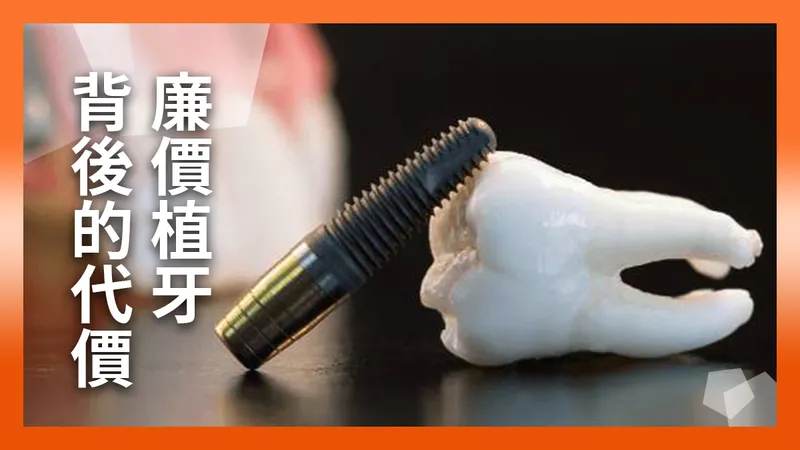 The Hidden Price of Cheap Implants