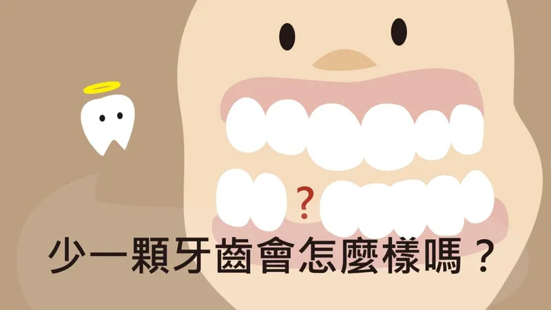 What Happens If You're Missing a Tooth?