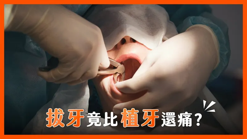 Which Hurts More: Extraction or Implants?
