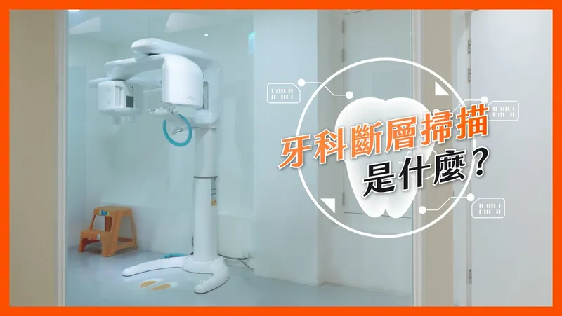 Dental CT Scans Explained