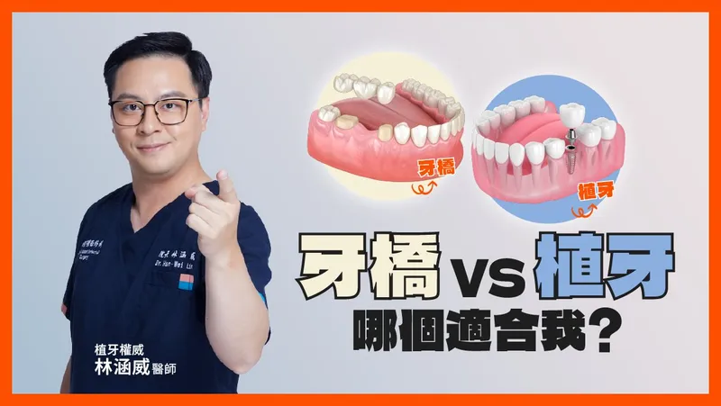 There's More Than One Way to Replace a Missing Tooth! Bridge vs. Implant: 3 Key Points at a Glance🔍