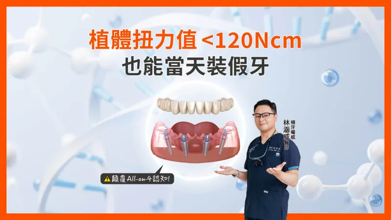 顛覆認知!All-on-4 植體扭力值 <120Ncm也能當天裝假牙?