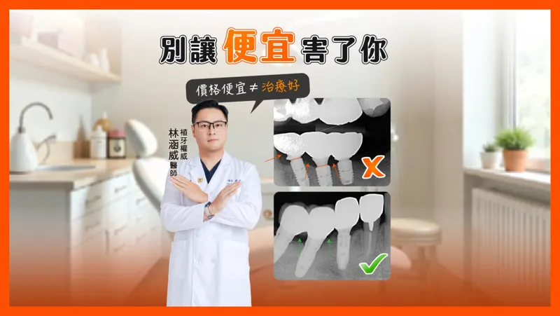 植牙失敗的隱形殺手!X光片揭露:假牙沒裝到位、植體位置錯誤,你還在相信低價促銷嗎?
