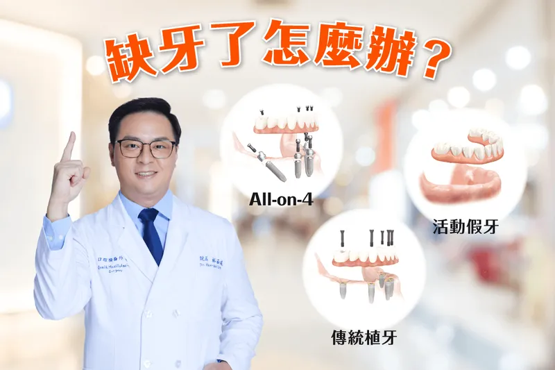 How to Choose Removable Dentures: Denture Types Explained