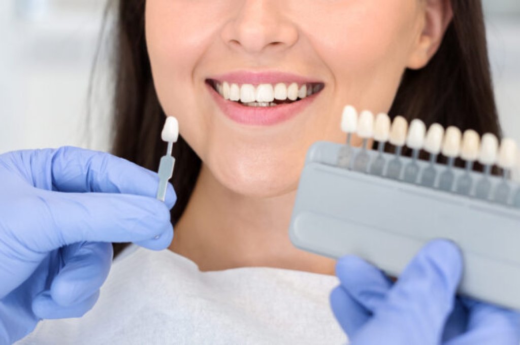 Dentist in blue medical gloves applying sample from tooth enamel scale to happy woman patient teeth to pick up right shade, teeth bleaching procedure, cropped, panorama